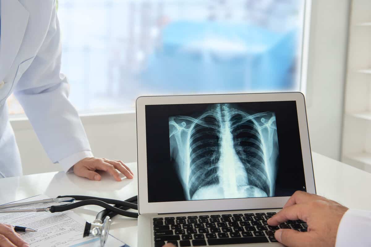 X-ray images on a laptop screen